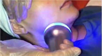 Kryoslimming maskin