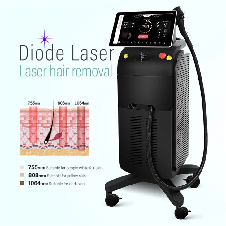 Smartere diode laser hårfjerningsmaskin