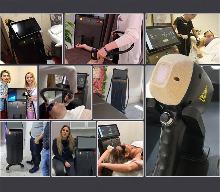 Commercial Laser Hair Removal Machine