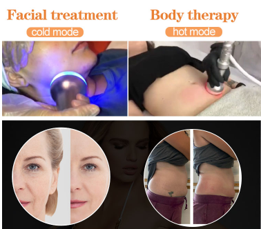 Cryo + Thermal + EMS 2 Wands + 2 Pads - Advanced Beauty Technology For Superior Skin Care high quality