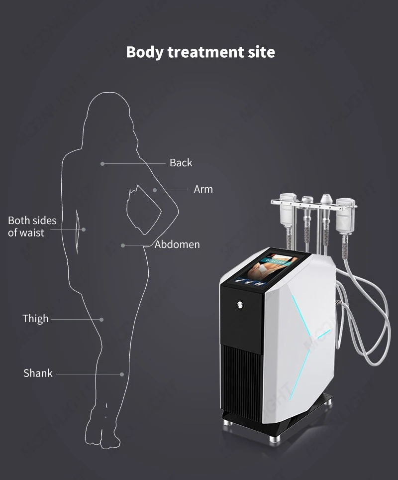 Cryoskin Machine Treatment