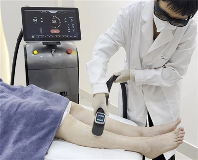 4-bølgelengde diode laser hårfjerning