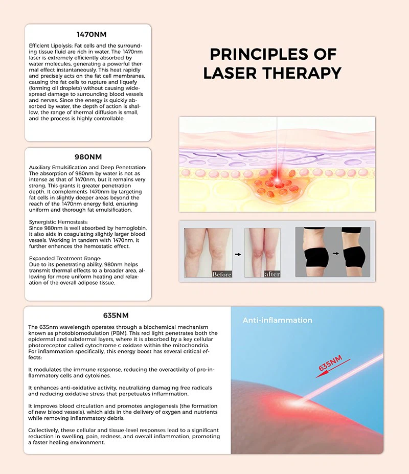 6980nm1470nm635nm11 6980nm1470nm635nm11